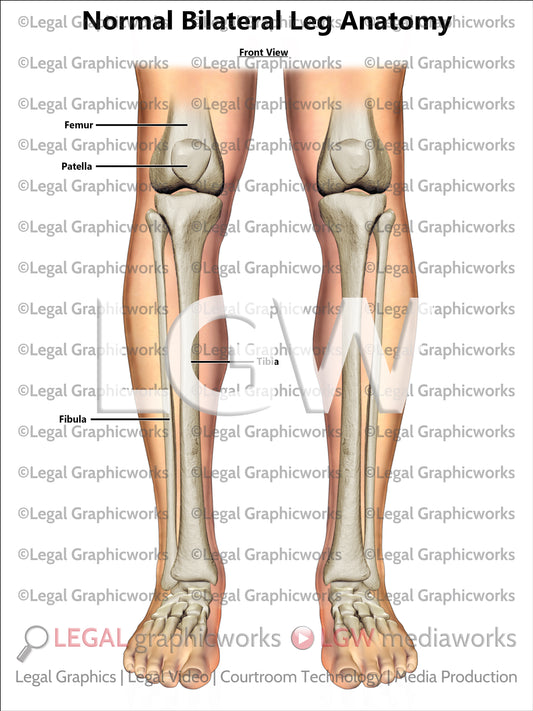 Normal Bilateral Leg Anatomy