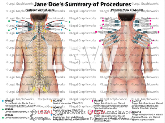 Summary of Procedures