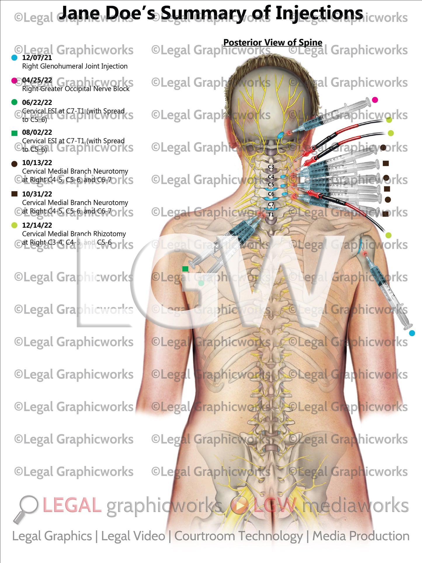 Summary of Injections