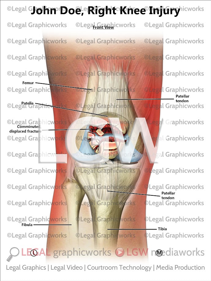 Right Knee Injury