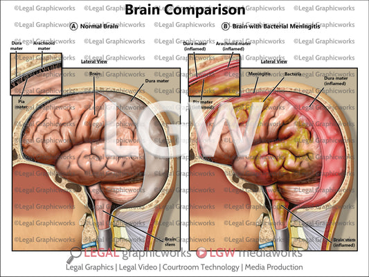 Brain Comparison