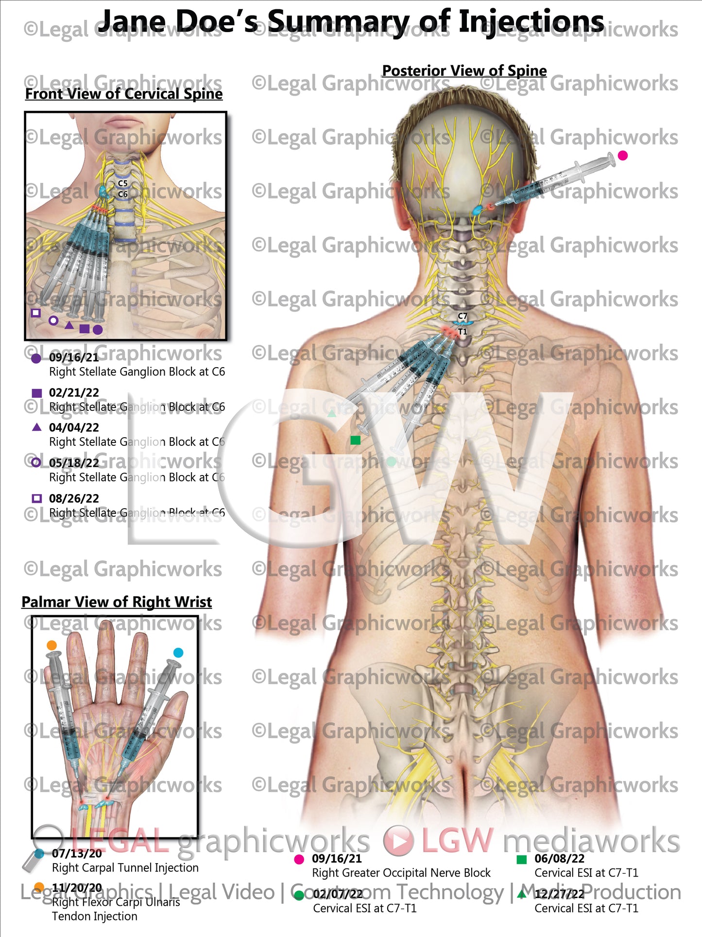 Summary of Injections