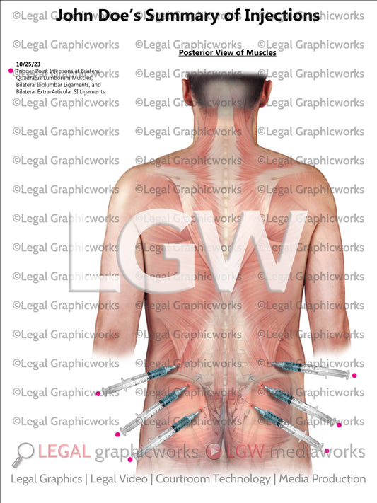 Summary of Injections