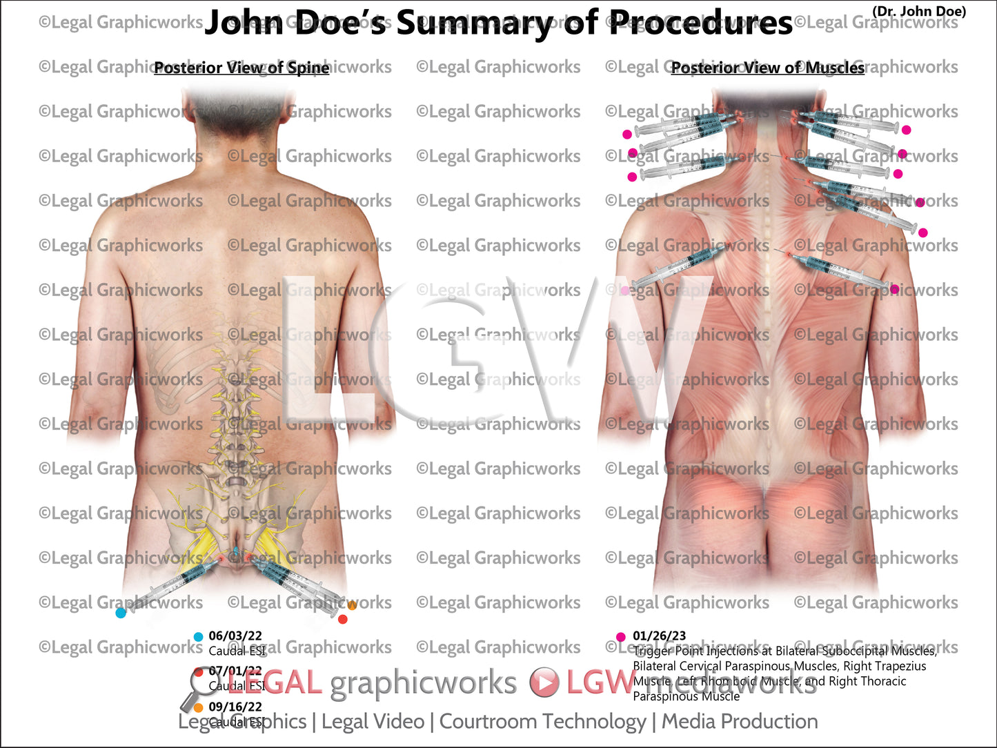 Summary of Procedures