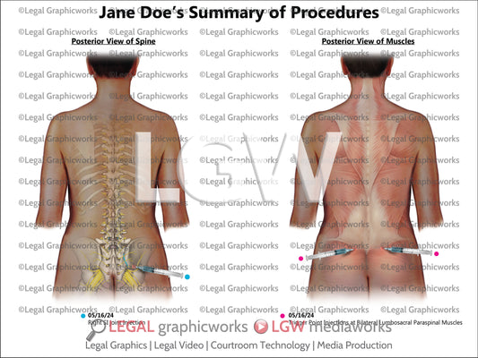 Summary of Procedures