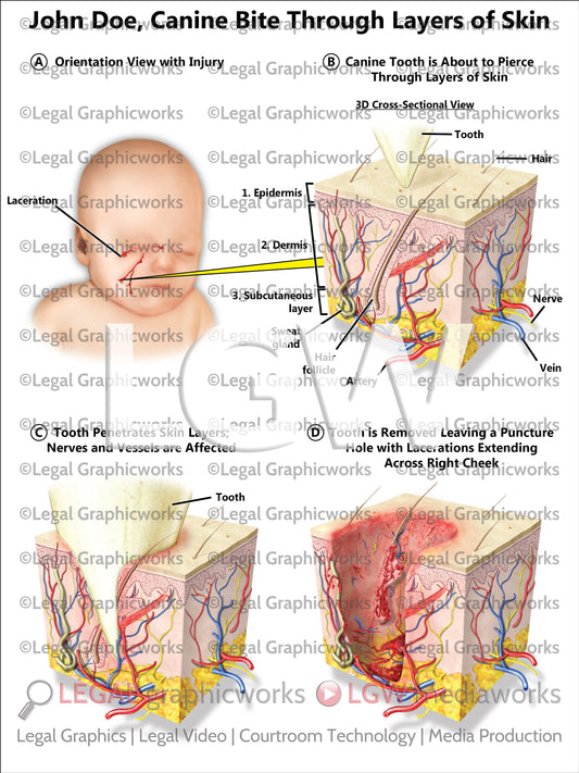 Canine Bite Through Layers of Skin